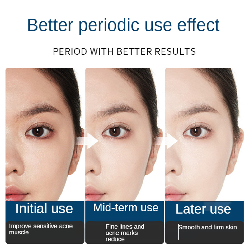 Лиофилизированная пудра для во – обзор и цена Oligopeptide Wrinkle