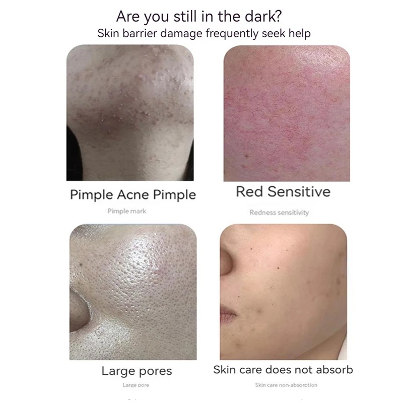 Набор лиофилизированного порош – обзор и цена Oligopeptide Wrinkle